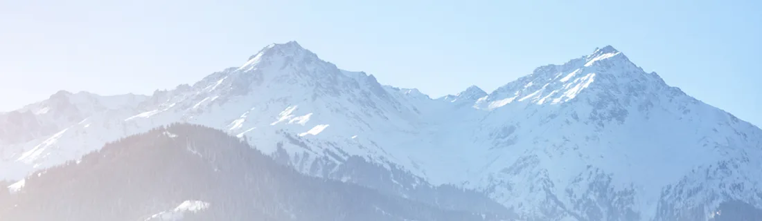 Dental Bridges in San Jose CA